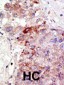 PIAS1 Antibody (N-term)